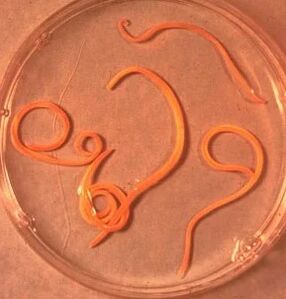 Parassiti dell'uomo ascaride