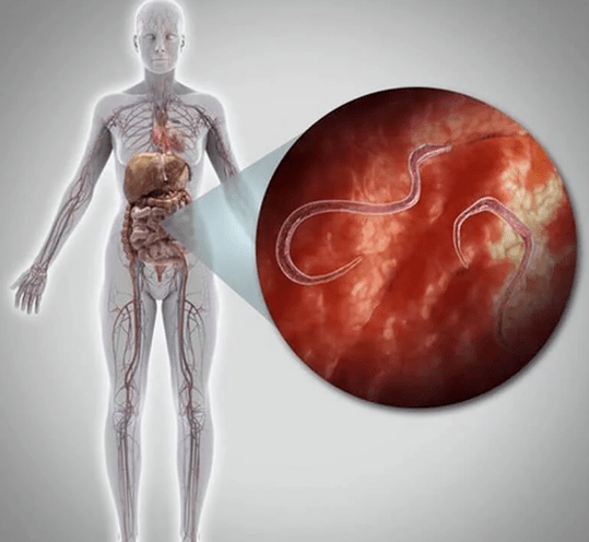 Parassiti nel corpo umano