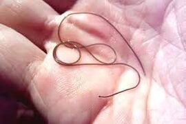 Parassita nel palmo della tua mano