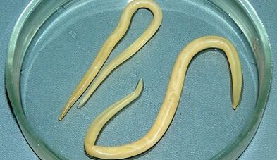 Come fare correttamente i test per l'ascariasi