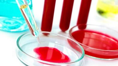 Esame del sangue per i parassiti