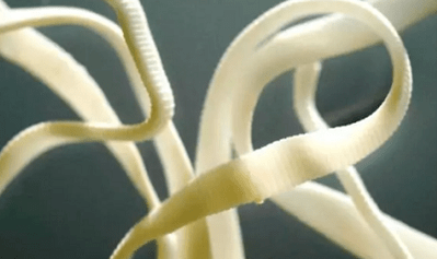 Come rimuovere i parassiti dal corpo umano