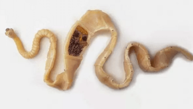 Come scoprire la presenza di parassiti nel corpo